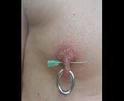 Flies On My With Canula And 5mm Circular Piercing Double Pierced Right Nipple from xxxx voa actress rasikhanna