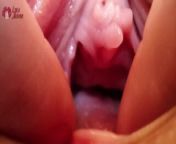 Extreme Pussy Close Up. Vaginal dilator from close up pussy fuking