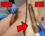 Dick Wax Depilation by Cute Esthetician. BEFORE and AFTER from pain in